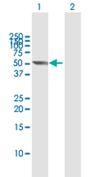 CYP2E1 MaxPab rabbit polyclonal antibody (D01)