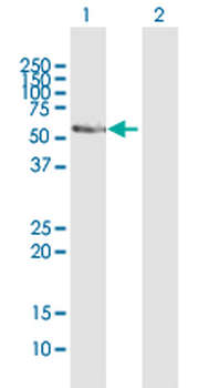 CYP2E1 purified MaxPab mouse polyclonal antibody (B01P)