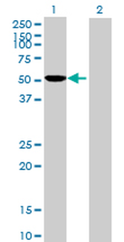 CYP2D6 purified MaxPab mouse polyclonal antibody (B01P)