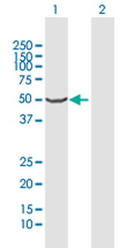 CYP2A13 MaxPab rabbit polyclonal antibody (D01)