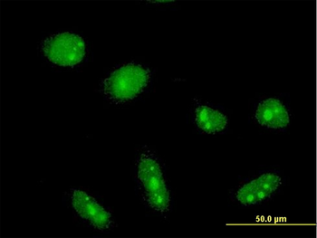 CYLD monoclonal antibody (M02), clone 3A9