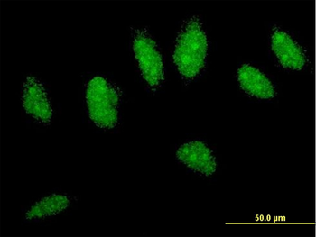 CYLD monoclonal antibody (M01), clone 2C3