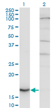 CYB5A monoclonal antibody (M06), clone 1A8