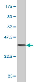 CYB5A monoclonal antibody (M06), clone 1A8