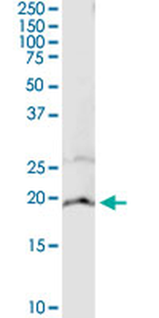 CYB5A monoclonal antibody (M05), clone 4C2