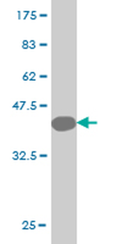 CYB5A monoclonal antibody (M05), clone 4C2