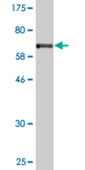 TEX28 monoclonal antibody (M05), clone 1A8