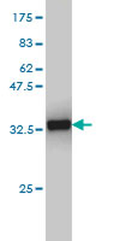 CX3CR1 monoclonal antibody (M01), clone 2B11