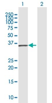 CTSS MaxPab rabbit polyclonal antibody (D01)