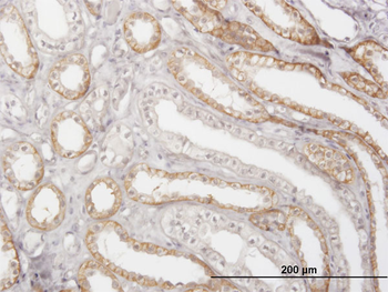 CTSK monoclonal antibody (M01), clone 2F1