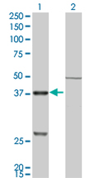 CTSK monoclonal antibody (M01), clone 2F1