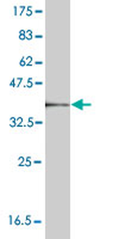 CTSK monoclonal antibody (M01), clone 2F1