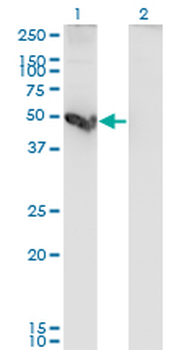 CTSE monoclonal antibody (M10), clone 2D5