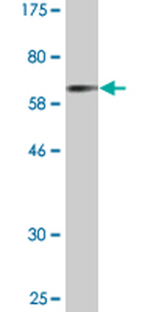 CTSE monoclonal antibody (M10), clone 2D5