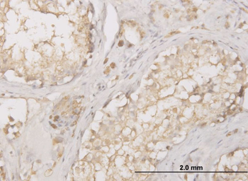 CTSD monoclonal antibody (M01), clone 3F12-1B9