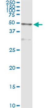 CTSD monoclonal antibody (M01), clone 3F12-1B9