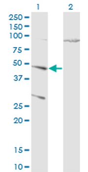 CTSD monoclonal antibody (M01), clone 3F12-1B9