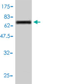 CTSD monoclonal antibody (M01), clone 3F12-1B9