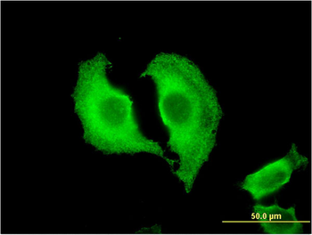 CTRB1 monoclonal antibody (M02), clone 3C8