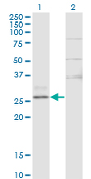 CTRB1 monoclonal antibody (M02), clone 3C8