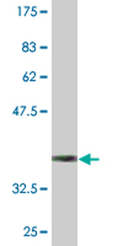 CTRB1 monoclonal antibody (M02), clone 3C8
