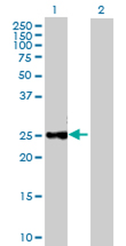 CTRB1 purified MaxPab mouse polyclonal antibody (B02P)