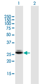 CTRB1 purified MaxPab mouse polyclonal antibody (B01P)