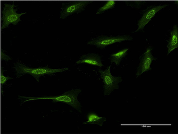 CTNND2 monoclonal antibody (M02), clone 1E3