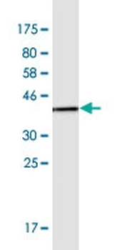 CTNND2 monoclonal antibody (M02), clone 1E3