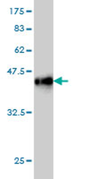 CTNND2 monoclonal antibody (M01), clone 6E11