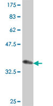 CTNND2 polyclonal antibody (A01)
