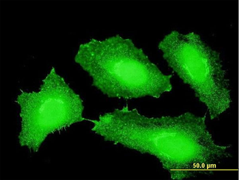 CTNNB1 monoclonal antibody (M06), clone 3A1