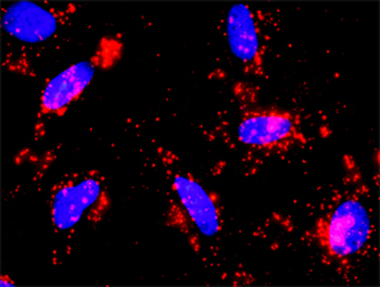 CTNNB1 monoclonal antibody (M06), clone 3A1
