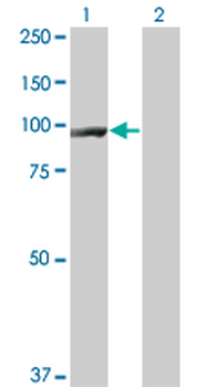 CTNNB1 monoclonal antibody (M06), clone 3A1