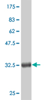 CTNNB1 monoclonal antibody (M06), clone 3A1