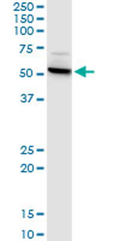 CTNS monoclonal antibody (M09), clone 5G6