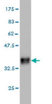 CTNS monoclonal antibody (M09), clone 5G6