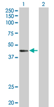 CTNS purified MaxPab rabbit polyclonal antibody (D01P)