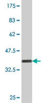CTNS polyclonal antibody (A01)