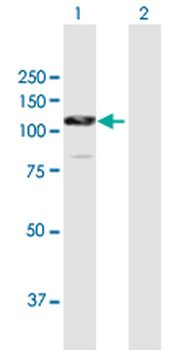 CTNNA2 MaxPab rabbit polyclonal antibody (D01)