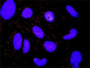 CTNNA1 monoclonal antibody (M03), clone 4G6