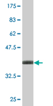 CTNNA1 monoclonal antibody (M03), clone 4G6