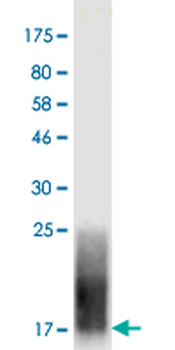 CTLA4 monoclonal antibody (M37), clone 5G6