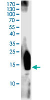CTLA4 monoclonal antibody (M33), clone 8D7