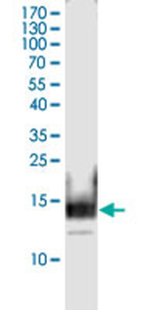 CTLA4 monoclonal antibody (M11), clone 5C12