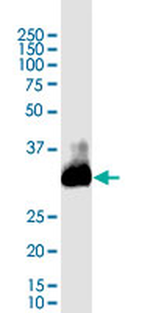 CTLA4 monoclonal antibody (M09), clone 2C8