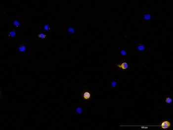 CTLA4 monoclonal antibody (M09), clone 2C8