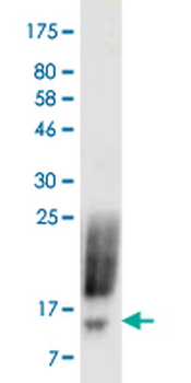 CTLA4 monoclonal antibody (M09), clone 2C8
