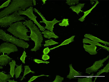 CTLA4 monoclonal antibody (M06), clone 2F1