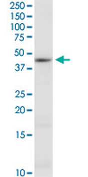CTH monoclonal antibody (M03), clone S51